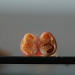 试管婴儿技术的常见误区与纠正指南