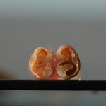 试管婴儿背后的故事：两个家庭的心路历程