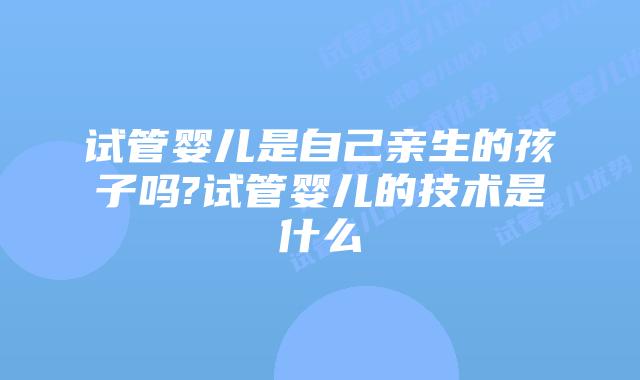 试管婴儿是自己亲生的孩子吗?试管婴儿的技术是什么