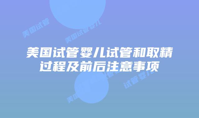 美国试管婴儿试管和取精过程及前后注意事项